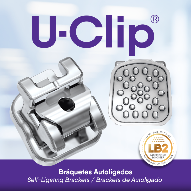 U-Clip