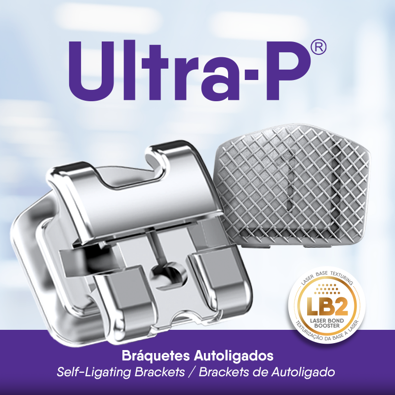 Ultra-P